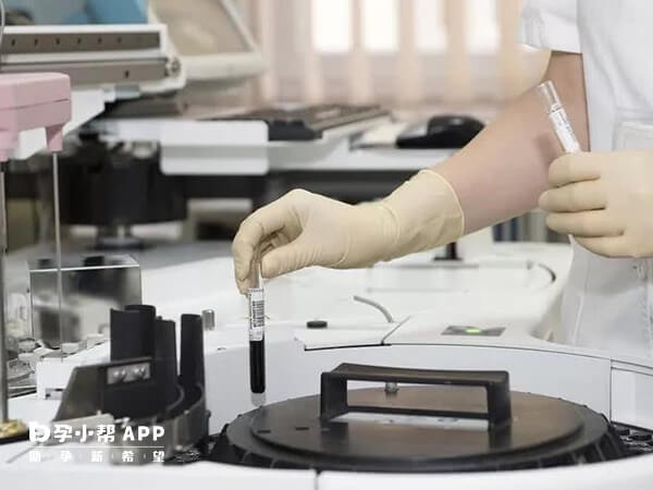 試管嬰兒實驗室費用較貴