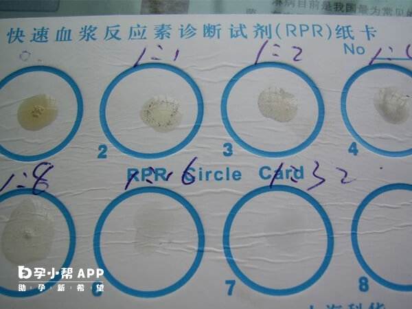 试管前要进一步检测RPR滴度