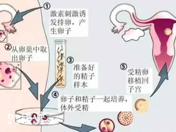 济医附院供精试管流程图