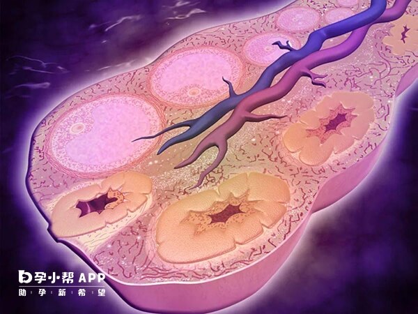 短方案促排对卵巢的刺激较小