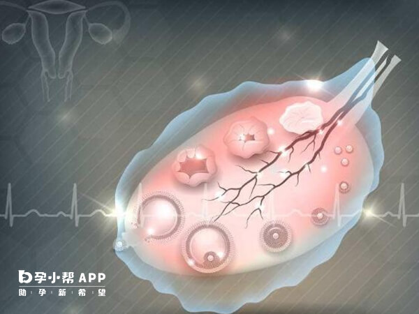 黄体期方案适用卵泡少的患者