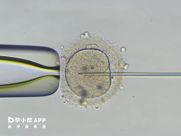 icsi二代试管不会进行PGD筛查