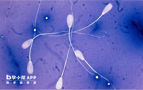 精子检查最好去正规三甲医院