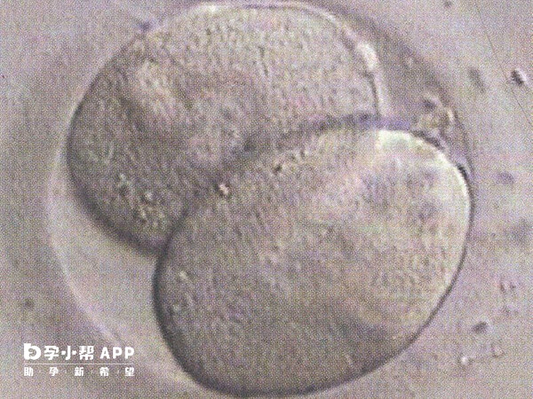 鲜胚移植适用于年轻试管婴儿患者