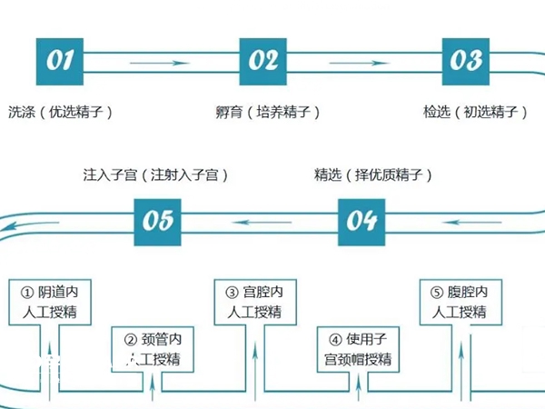 协和医院人工授精流程