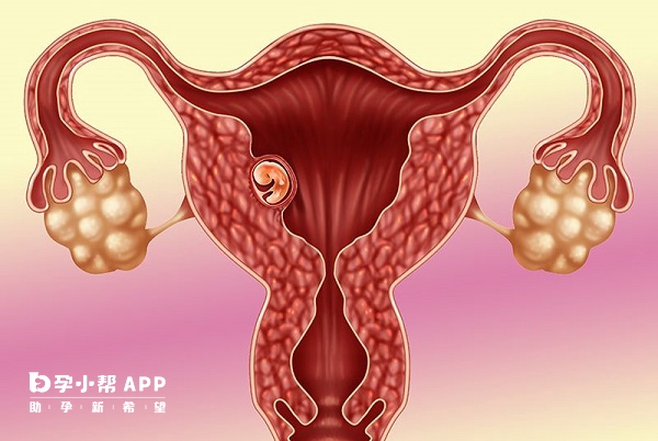 胚胎着床需要足够的孕酮