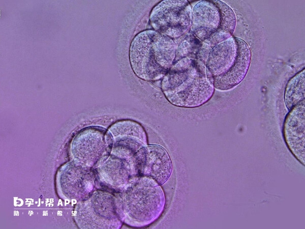 胚胎移植通常是选两个