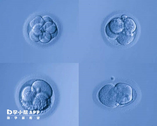 三代试管一般是需要囊胚培养的