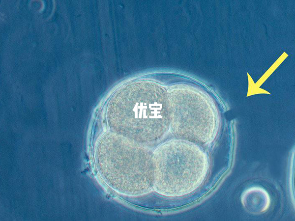 试管移植前用ah技术可以增加着床几率