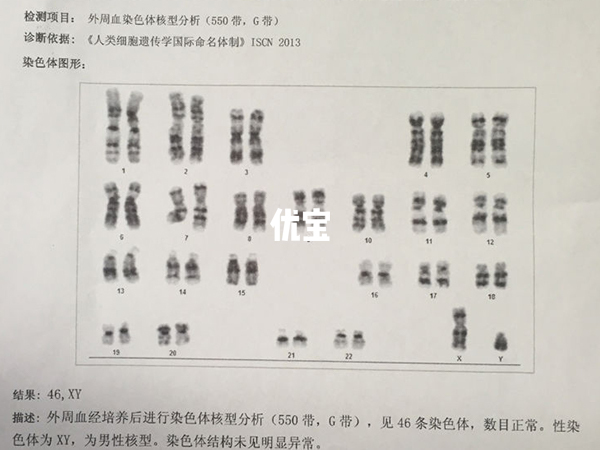 高龄试管前需要做染色体检查