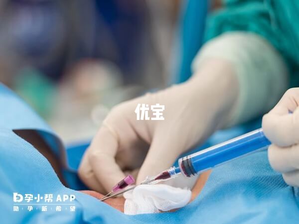 催產針又叫縮宮素