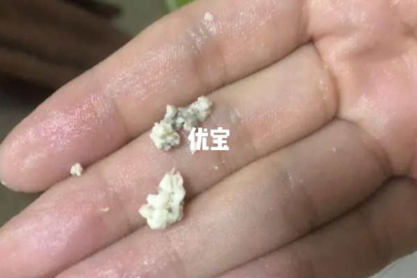 雪诺酮药渣正常颜色为白色