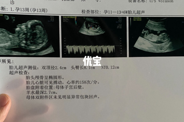 nt检查数据大于1点5怀男孩可能大