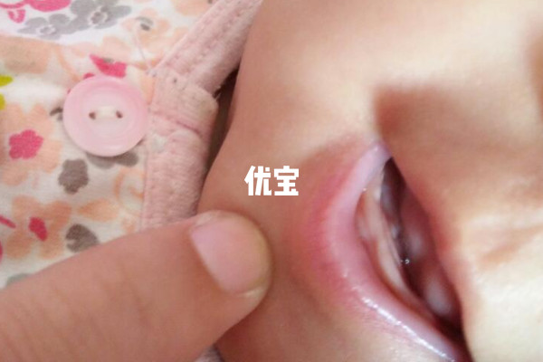 孩子乳牙张得早预示有大凶之兆