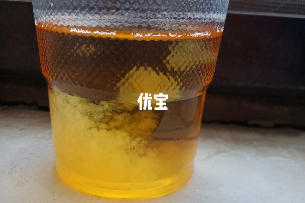 晨尿加盐变浑浊表示怀的是女孩