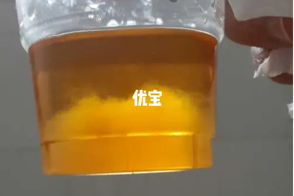 晨尿加酒精测男女不可信