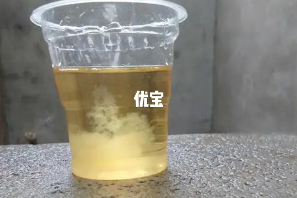 怀孕后的尿液颜色会发黄