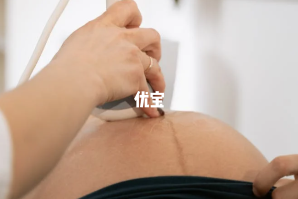 大宝中午11点出生二宝是男孩