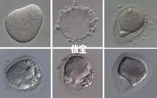 3bb囊胚移植的成功率较高