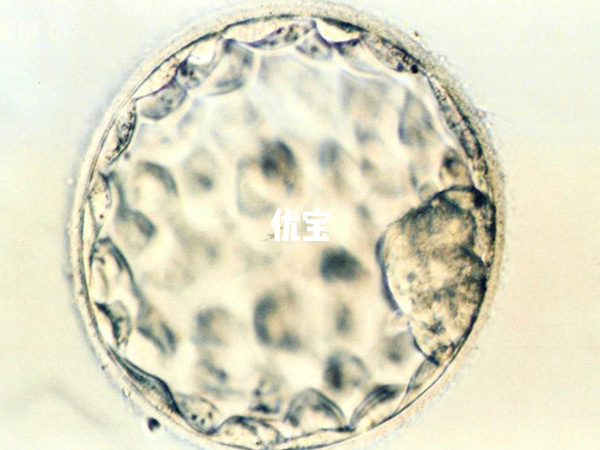 4bc囊胚移植的成功率较高