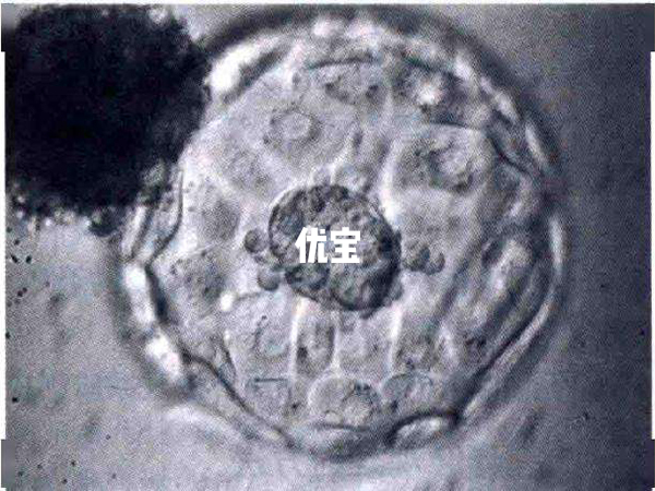 4AA囊胚移植成功率较高