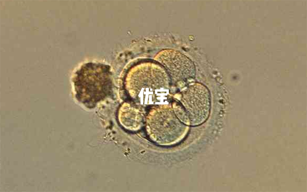 4bb囊胚移植成功率较高