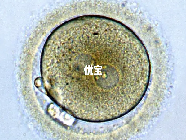 异常受精后做二代试管有相关风险