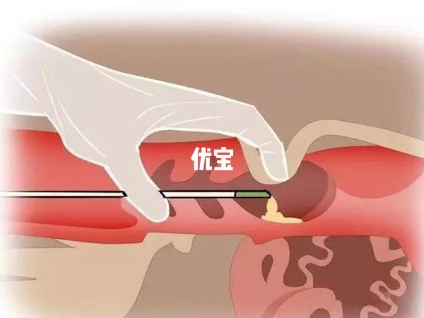 自己在家能做人工授精