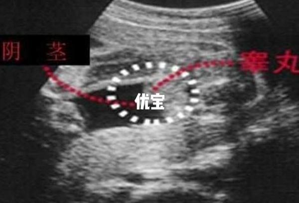 男宝剖腹产选择258的日子比较好