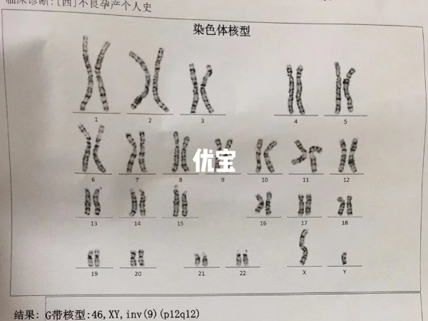 染色体异常需要选择第三代试管婴儿