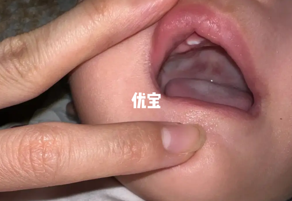 女孩单扎牙命不好