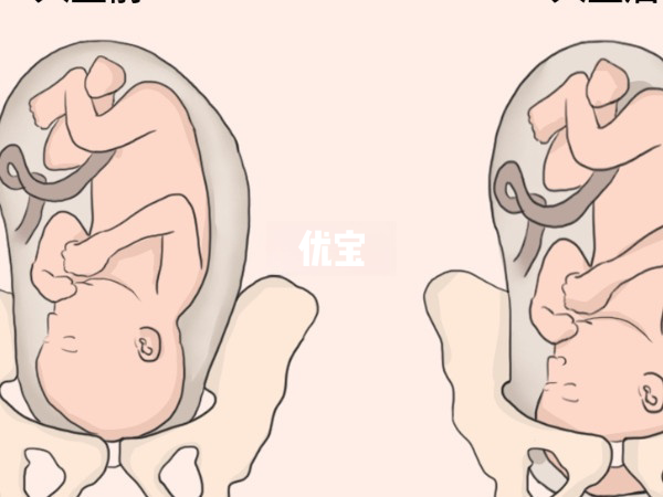 入盆早晚并不能看出男女