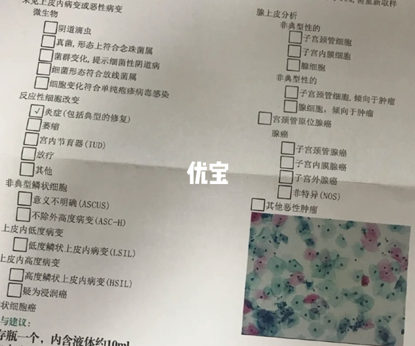 tct检查异常做试管婴儿有一定风险