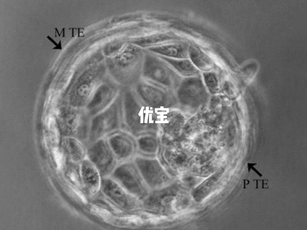 非优质胚胎不一定就是不好的胚胎