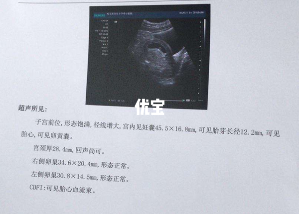 二维彩超报告单