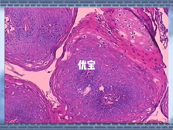 移植前泡澡对子宫内膜有一定修复作用