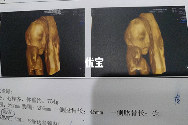 隔多久生二胎会换性别并无科学答案