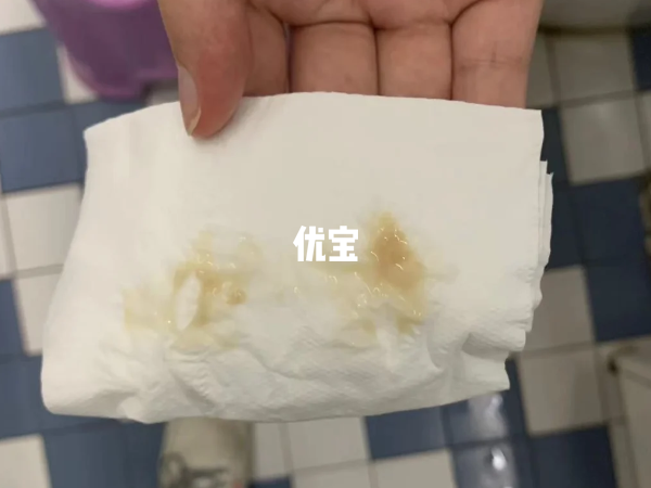 取卵前分泌物多的原因总结