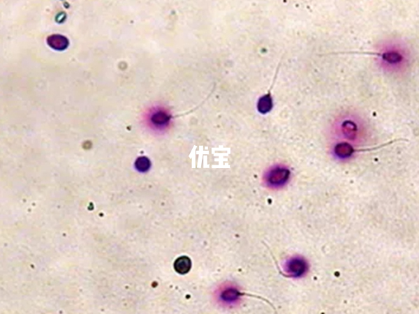 钙摄入不足精子的活力会大大减弱