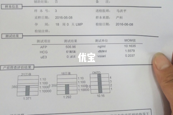 唐氏筛查报告单