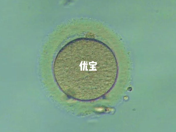 0pn的4BB囊胚可以用于试管移植