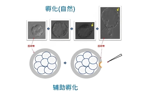 冻胚辅助孵化的过程