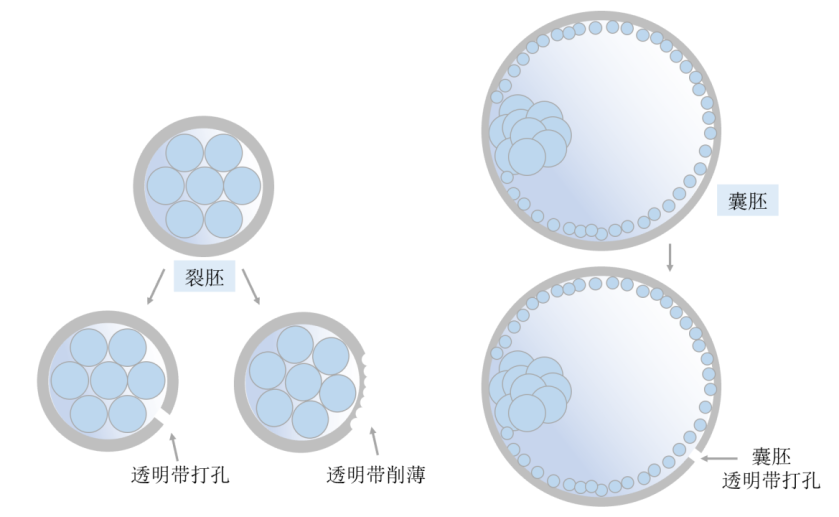 胚胎辅助孵化的方法