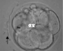 透明带削薄辅助孵化方法