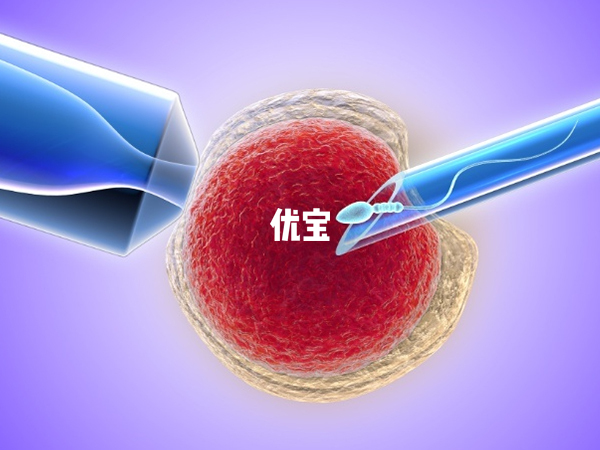 二代试管容易出现多精受精的情况