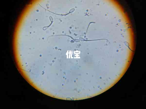 精子活力低不利于受孕