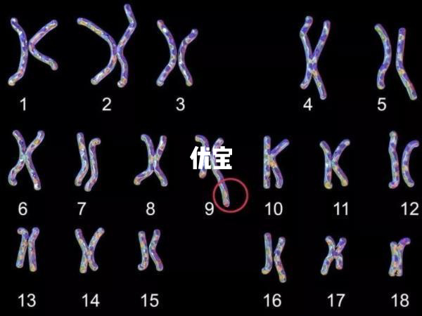 XXY染色体的人外表特征分析