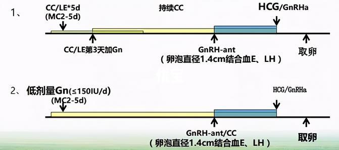 黄体期方案促排流程