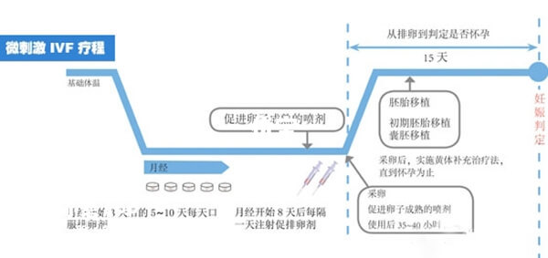 微刺激方案促排流程