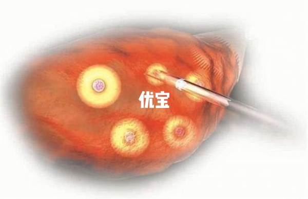 取卵后腹水70mm是不正常的